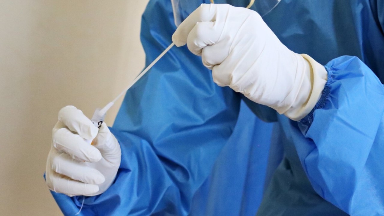 Avustralya'da Yeni Covid-19 Varyantı LP.8.1 Endişesi: Vakalar Artıyor